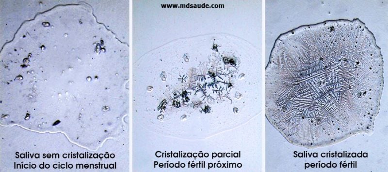 Ovula O Sintomas Causas E Testes Diagn Sticos Md Sa De