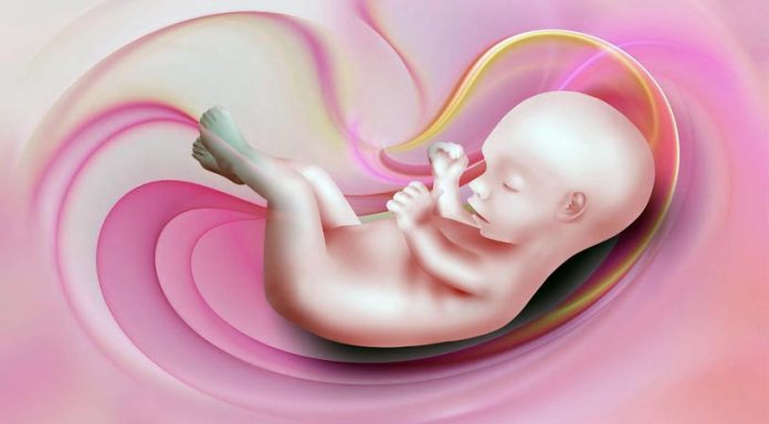 descolamento-placenta-imagem DESPRENDIMIENTO PREMATURO DE LA PLACENTA