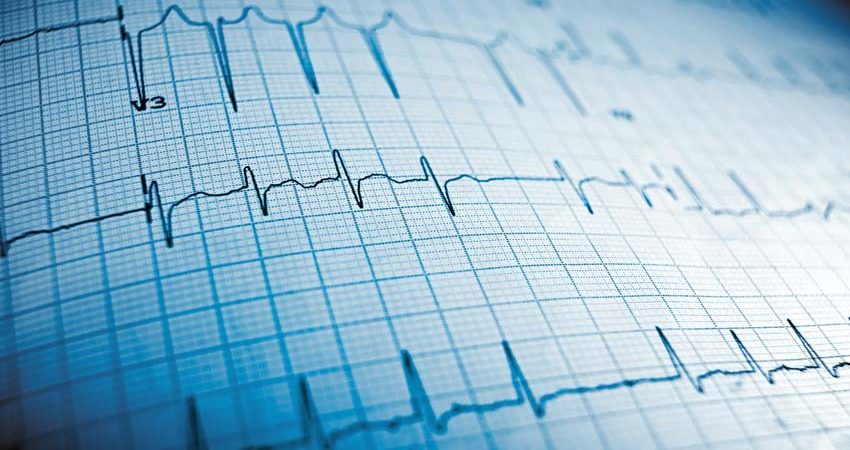 ELETROCARDIOGRAMA ECG Entenda os resultados mais comuns MD Saúde