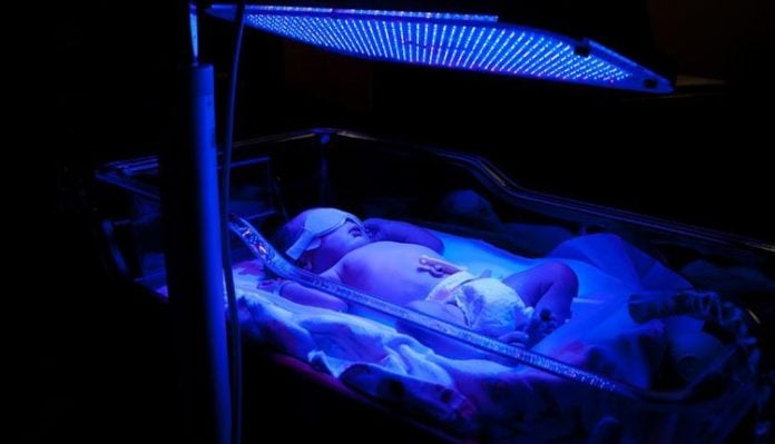 ictericia-neonatal Icterícia neonatal