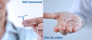 Dispositivo Intrauterino Diu De Cobre Y Mirena Md Sa De