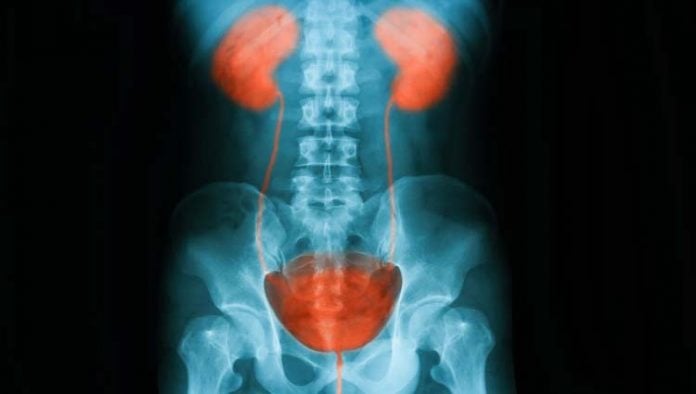 prevencao-itu infección urinaria