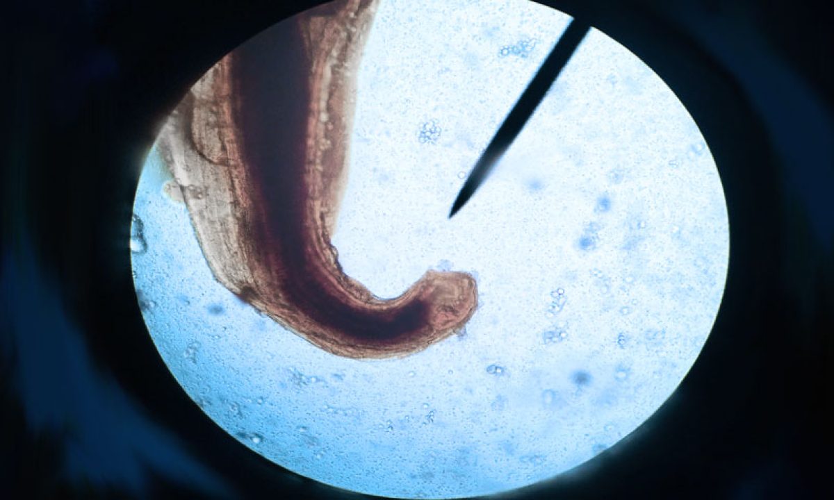 huevo de ancylostoma duodenale