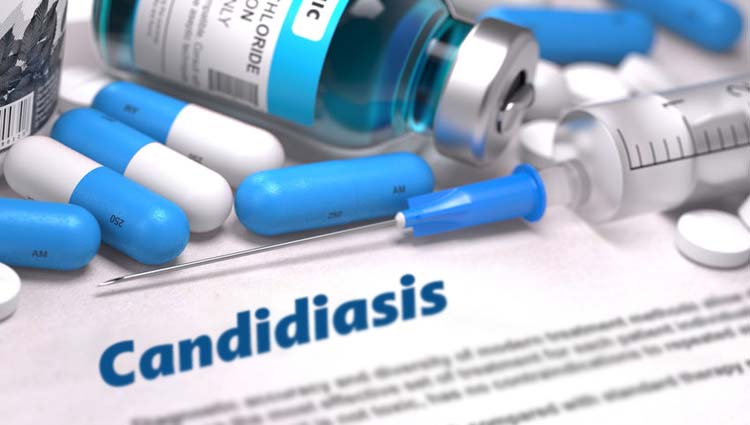 Candidiasis SÍntomas Tipos Y Causas Mdsaúde