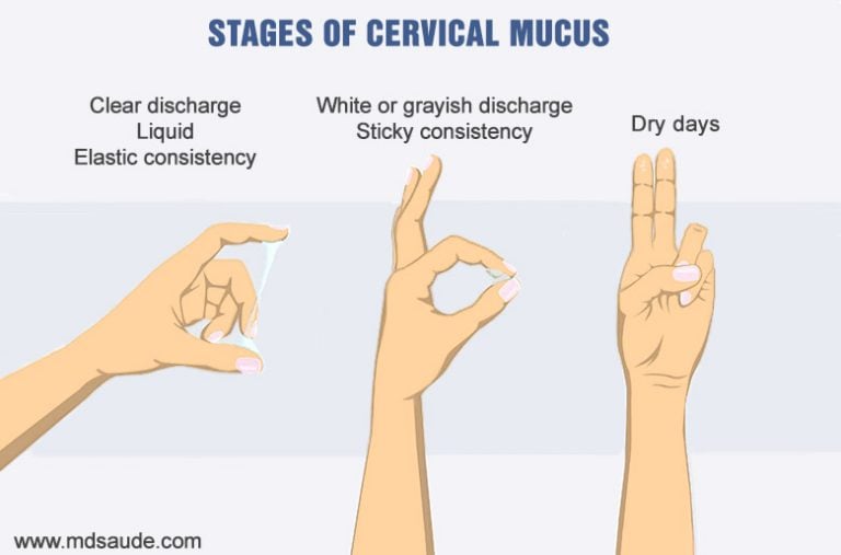 vaginal-discharge-color-explained-what-does-the-color-of-vaginal