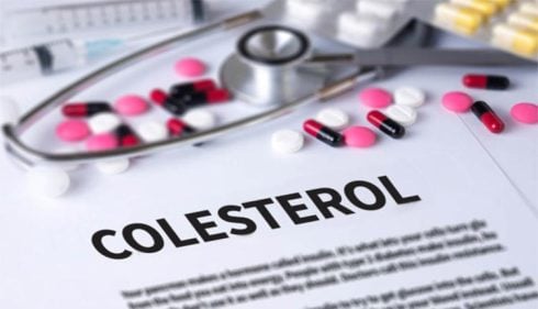 HDL Cholesterol: 38 mg/dL