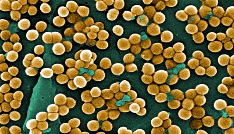 STAPHYLOCOCCUS AUREUS - Quais são os riscos desta bactéria? | MD.Saúde