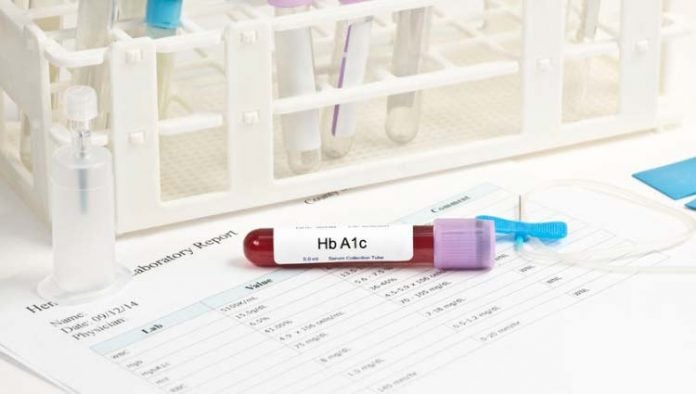 Hemoglobina Glicosilada Qué Es Valores Normales Y Cómo Bajarla Mdsaúde 2569