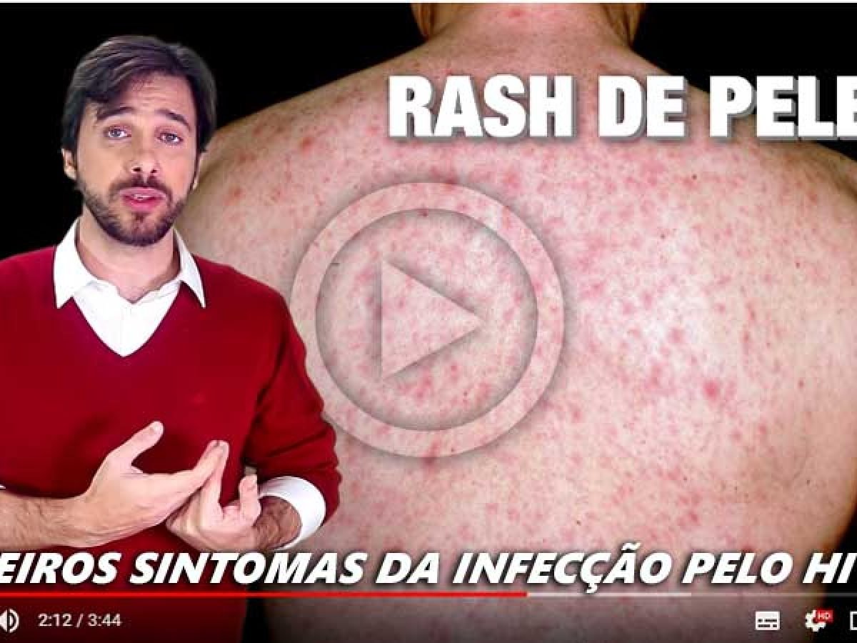 VÍDEO: Primeiros sintomas do HIV