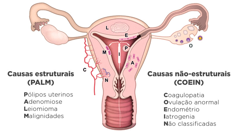 Causas comuns da falta de menstruação