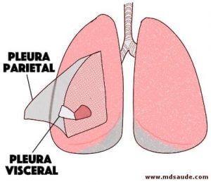 Derrame pleural qué es síntomas y tratamiento MD Saúde